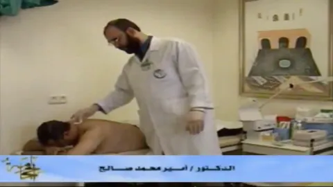 طريقة عمل الحجامة الصحيحة