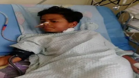خلو بالكم من اولادكم إصابة الطفل آدم بسبب آيس كريم النيتروجين